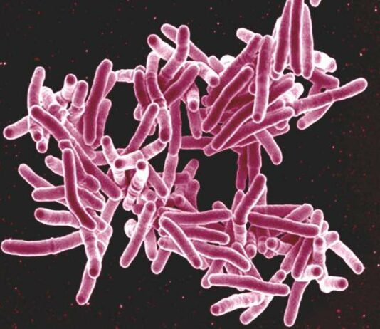 Η Πρόκληση στην Αντιμετώπιση και Πρόληψη της Φυματίωσης στον 21ο Αιώνα