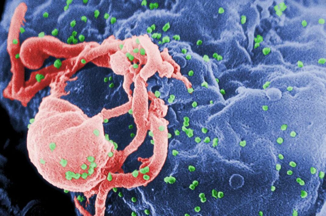Ο Έλεγχος της HIV Λοίμωξης χωρίς Αντιρετροϊκά Φάρμακα Αποτελεί Εφικτό Στόχο
