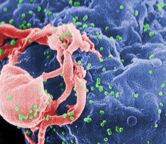 Ο Έλεγχος της HIV Λοίμωξης χωρίς Αντιρετροϊκά Φάρμακα Αποτελεί Εφικτό Στόχο