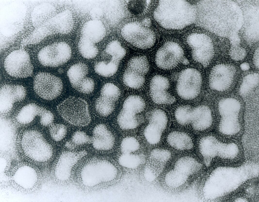 επιπλοκές της γρίπης